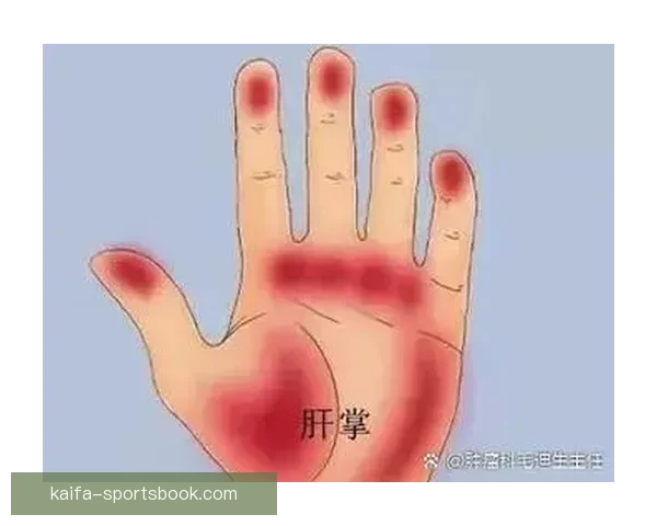 浓眉左手掌恢复良好 本月底接受复查有望本季复出